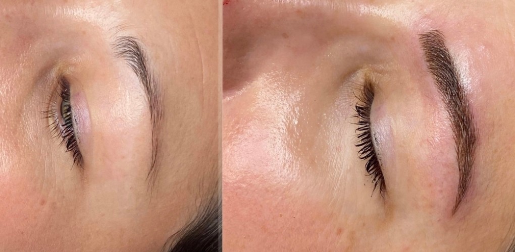 Nano Brows vs Microblading