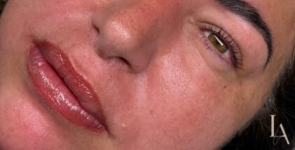 Lip Blush & Neutralisation
