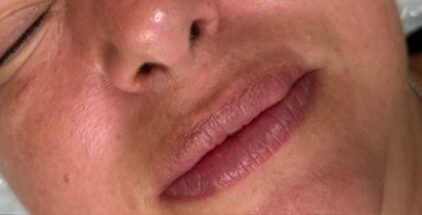 Lip-Blush-&-Neutralisation