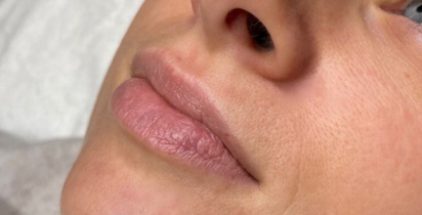 Lip Blush