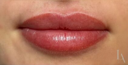 lip-blush-after-2