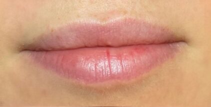 lip-blush-before-2
